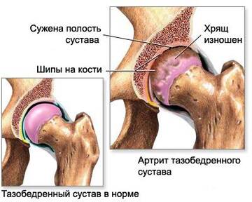 http://upforme.ru/uploads/0001/77/fd/341/t430273.jpg