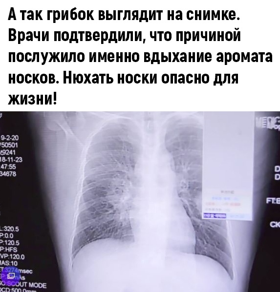 http://upforme.ru/uploads/0010/b8/af/2/t448960.jpg