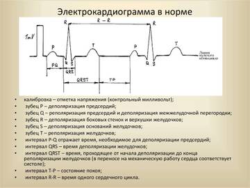 http://upforme.ru/uploads/0010/b8/af/39/t949841.jpg