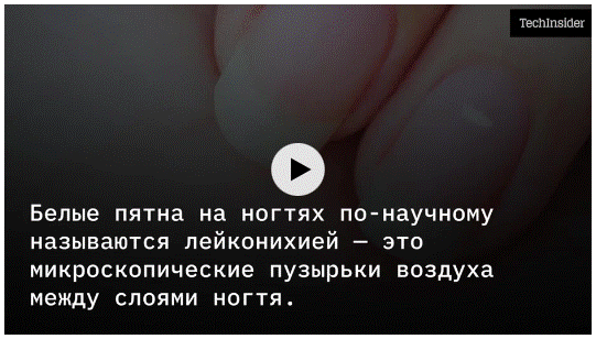 http://upforme.ru/uploads/0011/5d/92/2/881838.gif