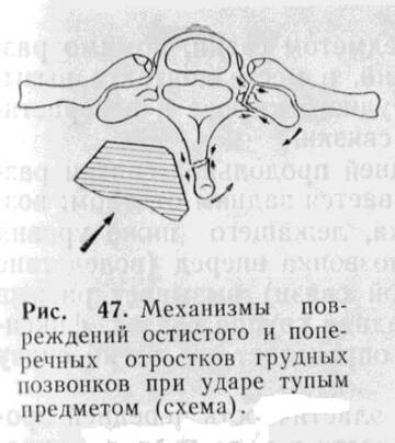 http://upforme.ru/uploads/001a/7e/41/2/t510920.jpg