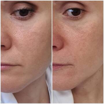 http://upforme.ru/uploads/001a/dd/52/121/t87540.jpg