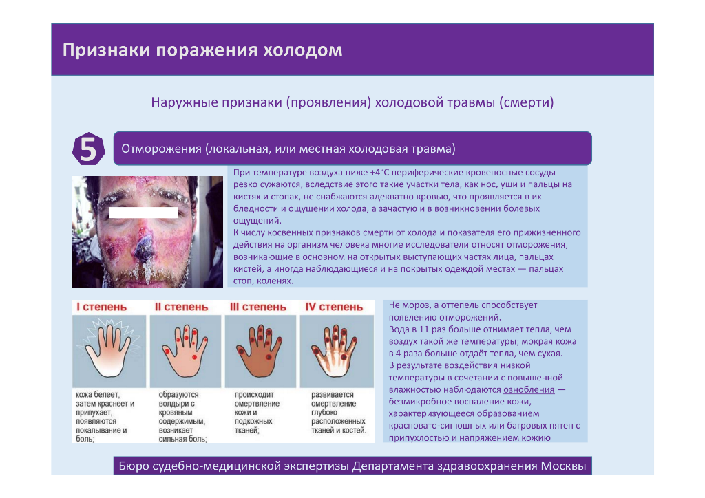 http://upforme.ru/uploads/001a/f5/a1/2/372261.png