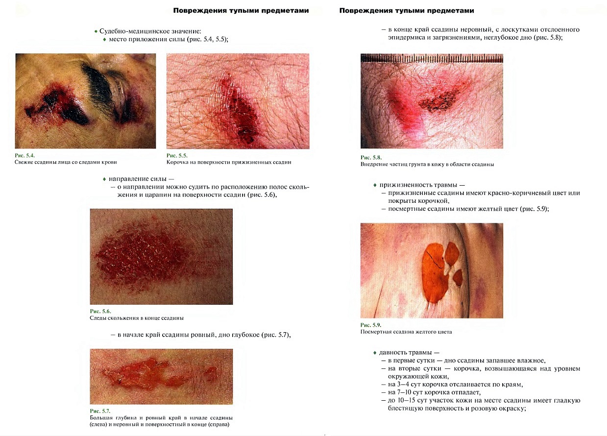 http://upforme.ru/uploads/001a/f5/a1/2/582296.jpg