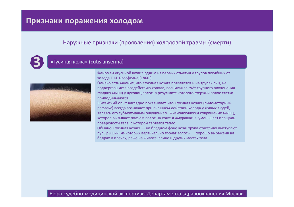 http://upforme.ru/uploads/001a/f5/a1/2/95070.png