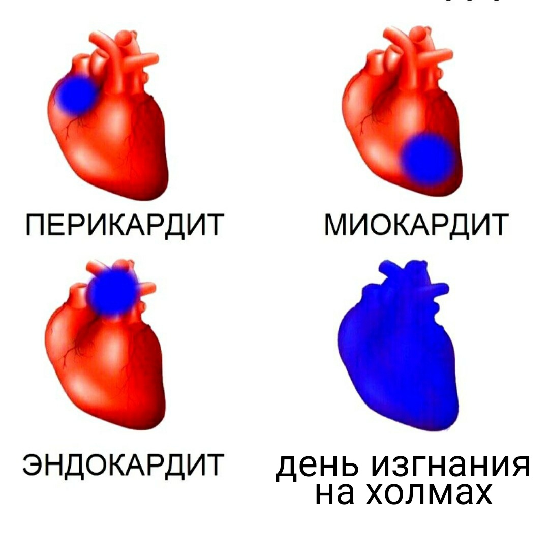 http://upforme.ru/uploads/001b/39/24/27/344238.jpg