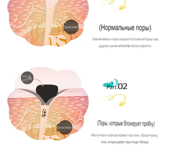 http://upforme.ru/uploads/001b/85/b1/2/t146396.png