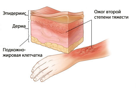 http://upforme.ru/uploads/001c/3e/b7/2/421862.jpg