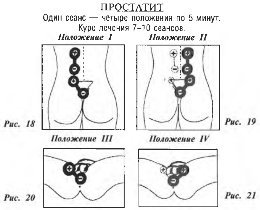 https://upforme.ru/uploads/0001/48/78/2003/375169.jpg