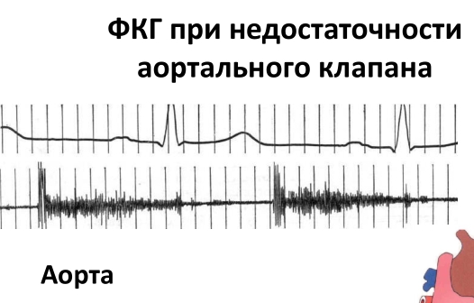 https://upforme.ru/uploads/0001/48/78/2003/669565.jpg