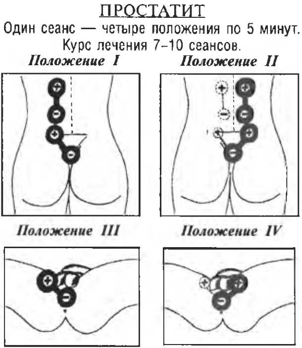 https://upforme.ru/uploads/0001/48/78/2003/683671.jpg