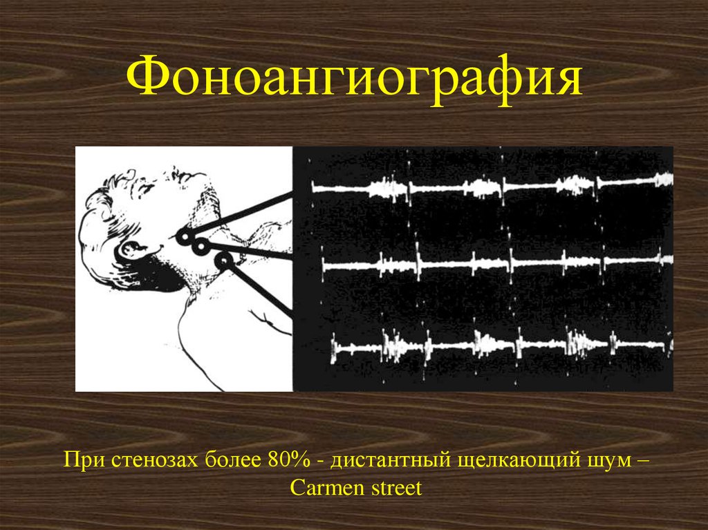 https://upforme.ru/uploads/0001/48/78/2003/859645.jpg