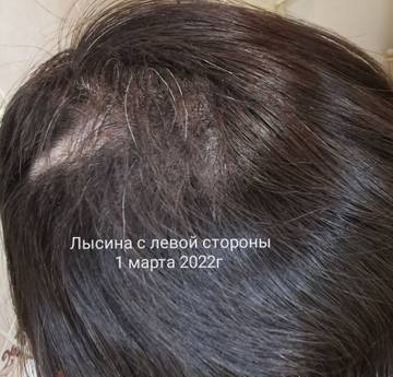 https://upforme.ru/uploads/0004/27/45/2345/t241792.jpg