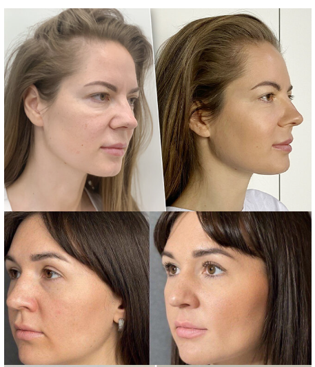 https://upforme.ru/uploads/0007/5b/f1/2/614191.png