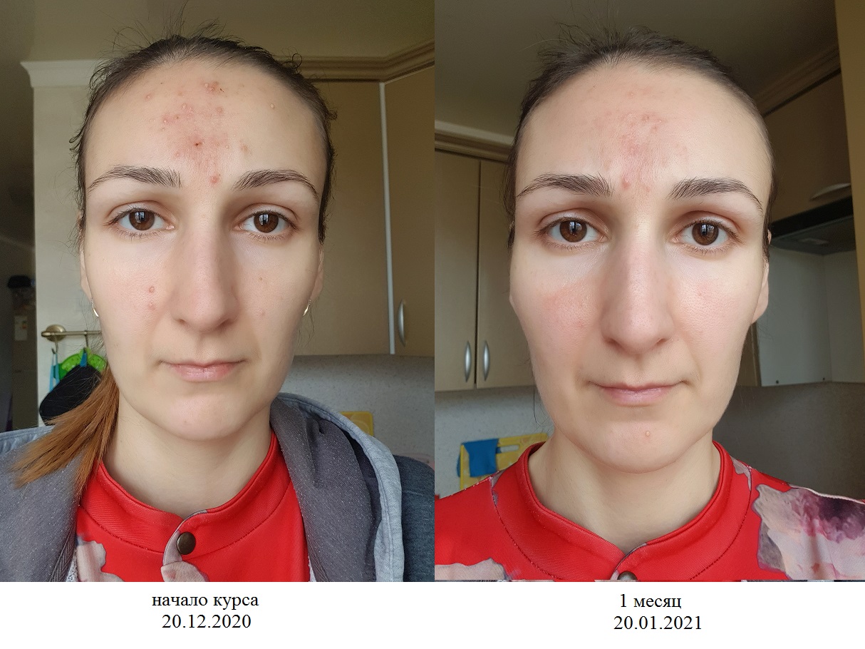 https://upforme.ru/uploads/0017/b4/0a/3/599901.jpg
