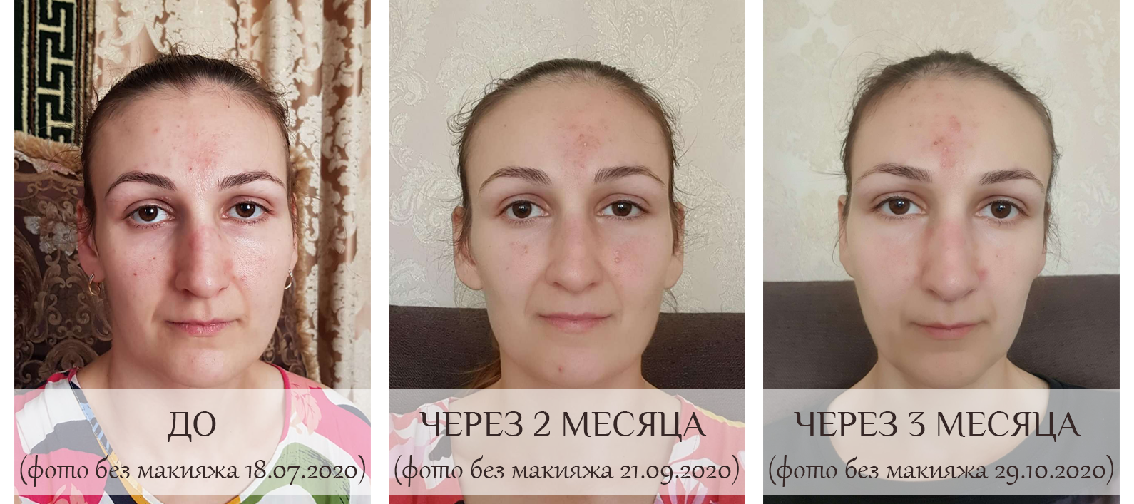 https://upforme.ru/uploads/0017/b4/0a/3/811411.png