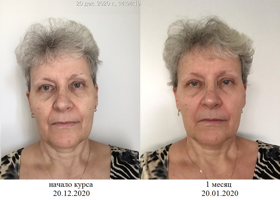 https://upforme.ru/uploads/0017/b4/0a/3/885764.jpg