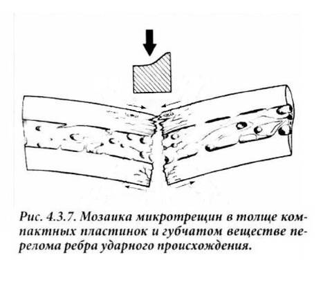 https://upforme.ru/uploads/001a/7e/41/2/t29102.jpg