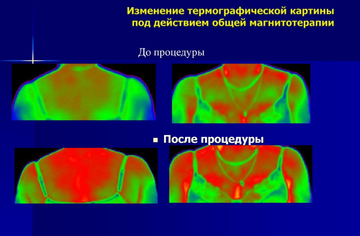 https://upforme.ru/uploads/001a/d9/f2/66/t789616.png