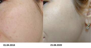 https://upforme.ru/uploads/001a/dd/52/8/t13850.jpg