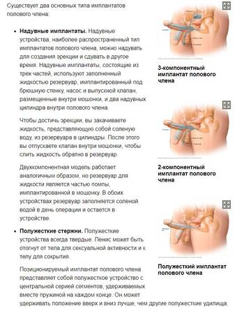 https://upforme.ru/uploads/001b/92/d8/66/t973462.jpg