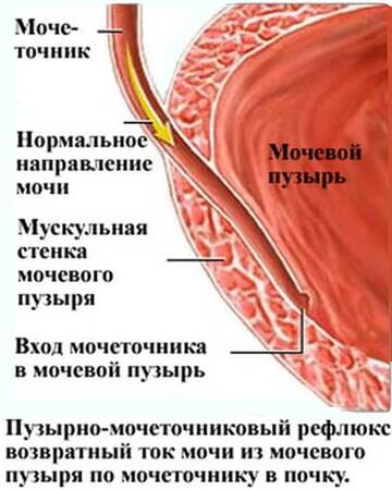 https://upforme.ru/uploads/001b/a3/de/2/t119405.jpg
