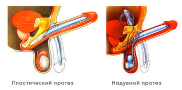 https://upforme.ru/uploads/001b/a3/de/2/t630184.jpg