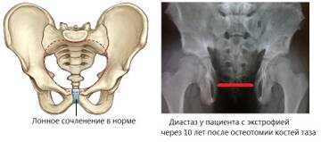 https://upforme.ru/uploads/001b/a3/de/2/t791291.jpg