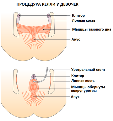 https://upforme.ru/uploads/001b/a3/de/2/t855538.png