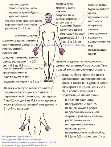 https://upforme.ru/uploads/001b/ce/12/126/t407442.png