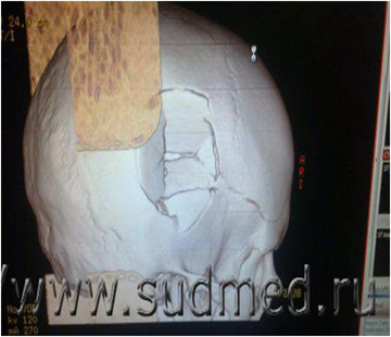 https://upforme.ru/uploads/001b/ce/12/126/t730722.png