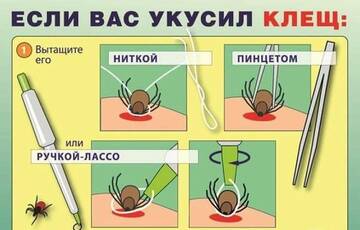 https://upforme.ru/uploads/001c/44/a7/2/t392914.jpg